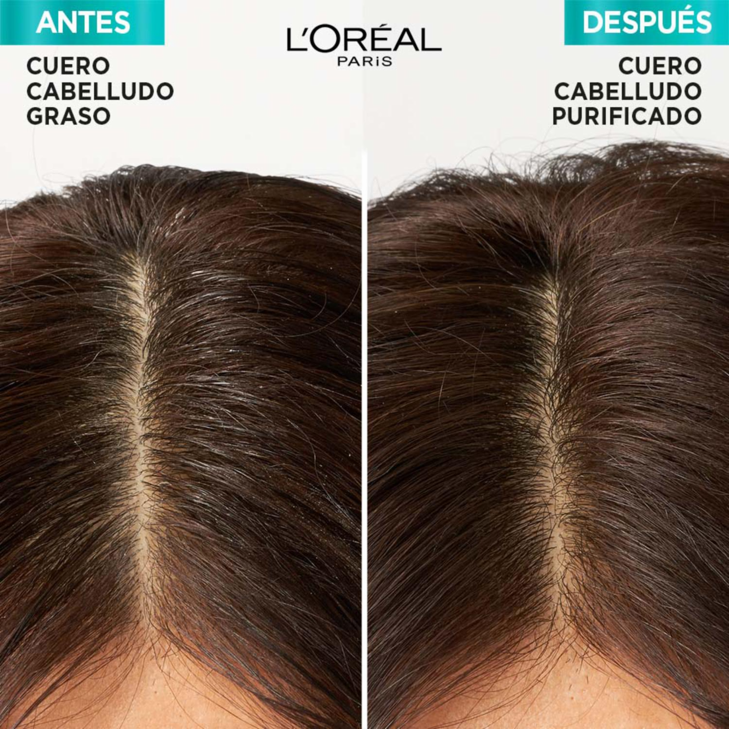 Acondicionador De Cabello Hialurónico Pure Para Raíz Grasa Y Puntas Deshidratadas ELVIVE L’ORÉAL 370 Ml